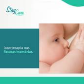 Laserterapia na Fissuras Mamárias em Americana 