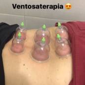 Sessão de Ventosaterapia 