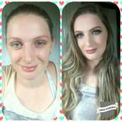 Antes × Depois 