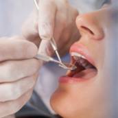 Tratamento Odontológico 