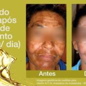 OLI OLA - O AUTÊNTICO PEELING EM CÁPSULAS