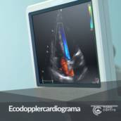 Ecodopplercardiograma