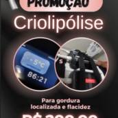 Criolipólise de placas  em Marília, SP por Florence Centro de Estética e Beleza