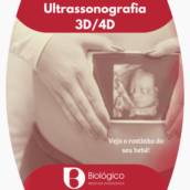 Ultrassonografia 3D/4D
