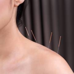 Acupuntura e Auriculoterapia 