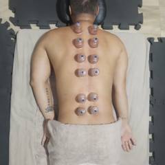 Liberação miofascial