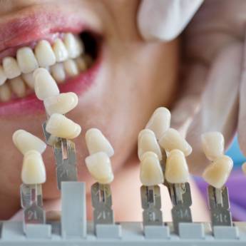 Comprar o produto de Restaurações Estéticas Diretas (Resina) em Odontologia em Resende, RJ por Solutudo