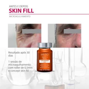 Comprar o produto de Concept T.I Skin Fill em Dermocosméticos em Americana, SP por Solutudo