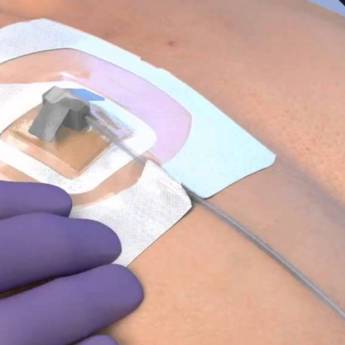 Comprar o produto de Manutenção de PORT A CATH a Domicílio em Bauru em Enfermeiros e Cuidadores em Bauru, SP por Solutudo