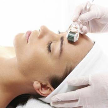 Comprar o produto de Microagulhamento em A Classificar em Bauru, SP por Solutudo