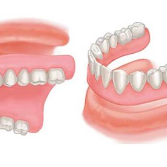 Comprar o produto de Prótese Total em Bauru em Odontologia em Bauru, SP por Solutudo