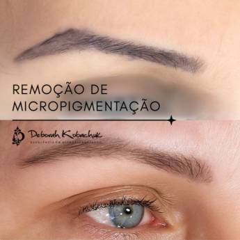 Comprar o produto de Remoção de Micropigmentação (sobrancelhas, Olhos e Lábios) em Beleza, Estética e Bem Estar em Foz do Iguaçu, PR por Solutudo
