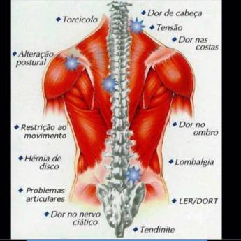 Comprar o produto de Tratamento de dor em Outros em Bauru, SP por Solutudo