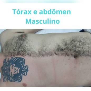 Comprar o produto de Depilação Tórax a Abdômen Masculino  em Depilação em Americana, SP por Solutudo
