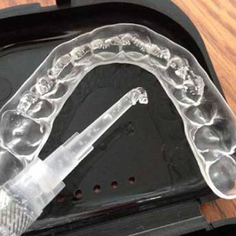 Comprar o produto de Clareamento Caseiro em Odontologia em Bauru, SP por Solutudo