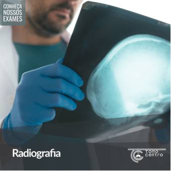 Comprar o produto de Radiografia  em Radiologia e Diagnóstico por Imagem em Botucatu, SP por Solutudo