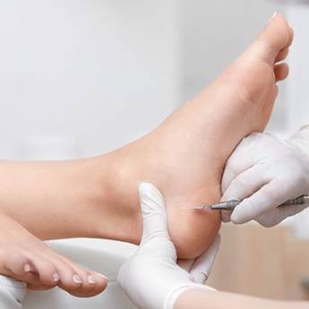 Comprar o produto de Plástica dos Pés em Pedicure em Jundiaí, SP por Solutudo