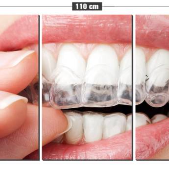 Comprar o produto de Clareamento Dental em Odontologia em Marília, SP por Solutudo