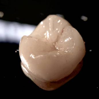 Comprar o produto de Coroa em Cerâmica Pura em Saúde em Jundiaí, SP por Solutudo