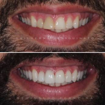 Comprar o produto de Lentes de contato em Outros Serviços em São Manuel, SP por Solutudo