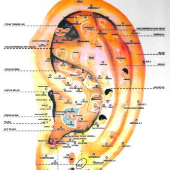 Comprar o produto de Tratamento de auriculoterapia em A Classificar em Bauru, SP por Solutudo