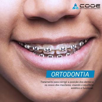 Comprar o produto de Ortodontia em Odontologia em Itapetininga, SP por Solutudo