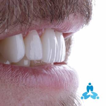 Comprar o produto de Lentes de Contato Dental em Odontologia em Itapetininga, SP por Solutudo