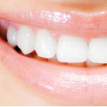 Comprar o produto de Aplicação de Selante em Odontologia em Jundiaí, SP por Solutudo