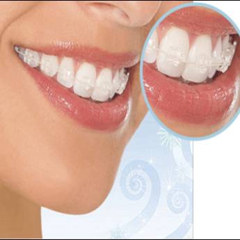 Comprar o produto de Aparelhos Fixos de Porcelana em Odontologia em Assis, SP por Solutudo