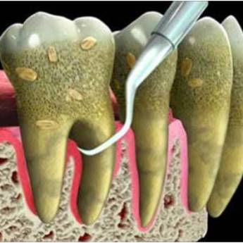 Comprar o produto de Periodontia em Odontologia em Assis, SP por Solutudo
