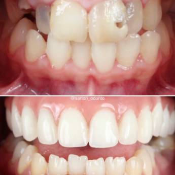 Comprar o produto de Tratamento dentário em Odontologia em Assis, SP por Solutudo