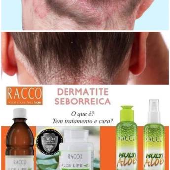 Comprar o produto de Tratamento Dermatite Seborreica em Cabelo em Bauru, SP por Solutudo