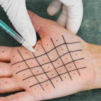 Comprar o produto de Hiperidrose em Beleza, Estética e Bem Estar em Bauru, SP por Solutudo