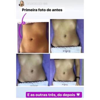 Comprar o produto de Detox Corporal em Beleza, Estética e Bem Estar em Bauru, SP por Solutudo