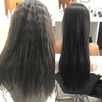 Comprar o produto de Antes e depois - Oxoplastia em Beleza, Estética e Bem Estar em Mineiros, GO por Solutudo