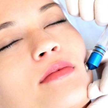 Comprar o produto de Peeling Diamante em Beleza, Estética e Bem Estar em Aracaju, SE por Solutudo