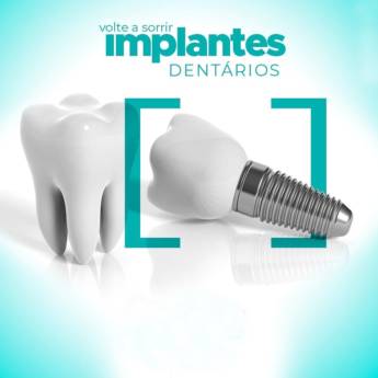 Comprar o produto de Implantes em Odontologia em Assis, SP por Solutudo
