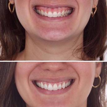 Comprar o produto de Gengivectoplastia em A Classificar em Bauru, SP por Solutudo