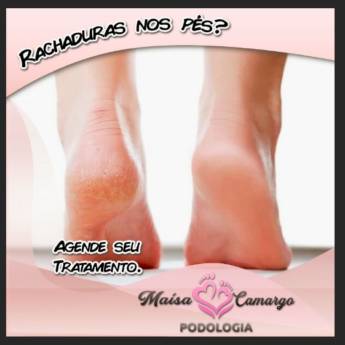 Comprar o produto de Tratamento de Calosidade e Rachaduras em Podologia em Botucatu, SP por Solutudo