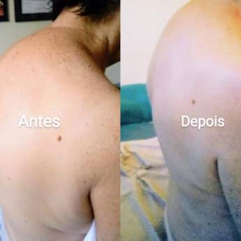 Comprar o produto de  Liberação Miofascial para Coluna - Alívio e Bem-Estar em Ourinhos/SP em Saúde em Ourinhos, SP por Solutudo