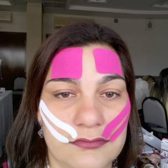 Comprar o produto de Uso de bandagem terapêutica e Eletroestimulação em Fonoaudiologia em Apucarana, PR por Solutudo