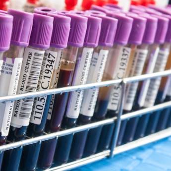 Comprar o produto de Marcadores Tumorais em Exames  em Foz do Iguaçu, PR por Solutudo