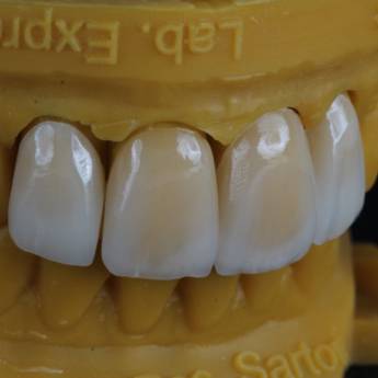 Comprar o produto de Prótese Dentária em Odontologia em Assis, SP por Solutudo