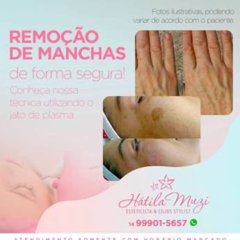 Comprar o produto de Remoção de Manchas (Técnica Jato de plasma) em Clínicas de Estética e Beleza em Marília, SP por Solutudo