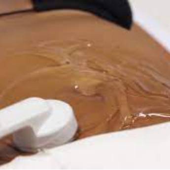 Comprar o produto de  Drenagem Linfática e Ultrassom (Pré e Pós Operatório) - Cuidados Essenciais no Rio de Janeiro/RJ em Clínicas de Estética e Esteticistas pela empresa Encanto Estética em Rio de Janeiro, RJ por Solutudo