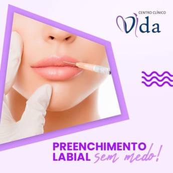 Comprar o produto de Preenchimento Labial em Estética Facial em Assis, SP por Solutudo