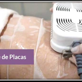 Comprar o produto de Criolipólise de placas em Fisioterapia em Piracicaba, SP por Solutudo