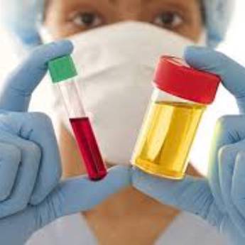 Comprar o produto de Exames laboratoriais em Exames  em Osasco, SP por Solutudo