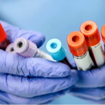 Comprar o produto de Tipagem Sanguínea  em Exames  em Itaituba, PA por Solutudo