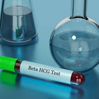 Comprar o produto de Teste de Gravidez  em Exames  em Itaituba, PA por Solutudo